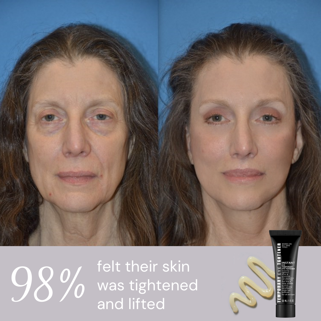 Last 3 hours: 70% off 🔥Instant Firming Eye Serum, new formula, extreme lifting and smoothing effect❤️