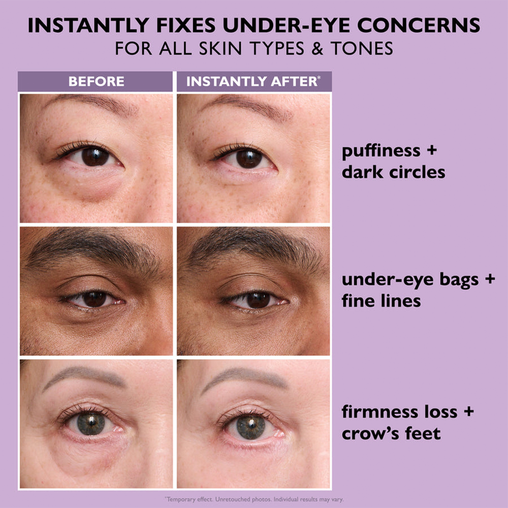 Last 3 hours: 70% off 🔥Instant Firming Eye Serum, new formula, extreme lifting and smoothing effect❤️