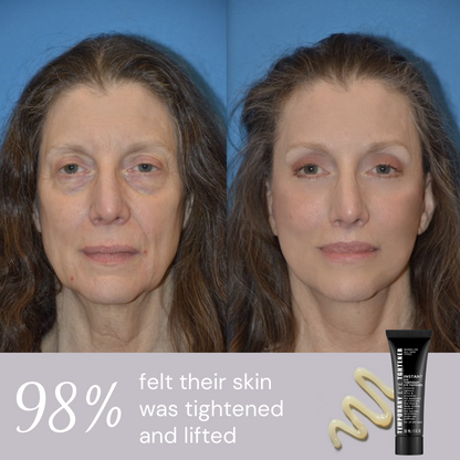 Last 3 hours: 70% off 🔥Instant Firming Eye Serum, new formula, extreme lifting and smoothing effect❤️